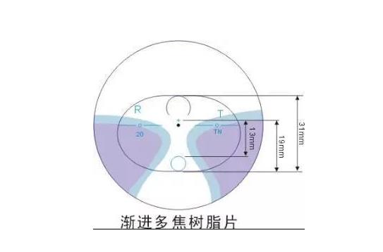 美麗島多焦鏡適合的人群，需要注意的事項